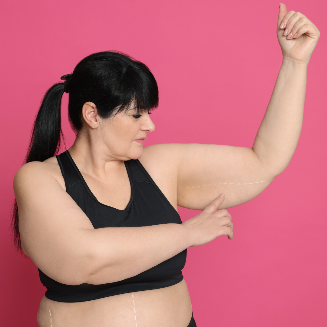 L'obésité et le combat d'Alexandra dans ses différentes perte de poids